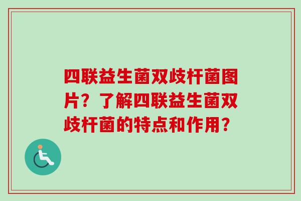 四联益生菌双歧杆菌图片？了解四联益生菌双歧杆菌的特点和作用？