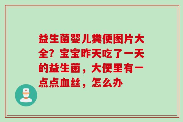 益生菌婴儿粪便图片大全？宝宝昨天吃了一天的益生菌，大便里有一点点丝，怎么办