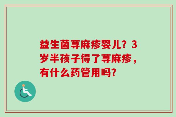 益生菌荨麻疹婴儿？3岁半孩子得了荨麻疹，有什么药管用吗？