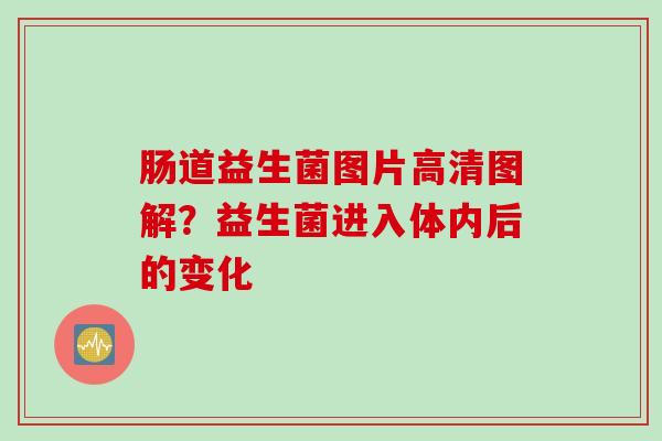 肠道益生菌图片高清图解?益生菌进入体内后的变化 肠道益生菌图片高清图解?益生菌进入体内后的变化