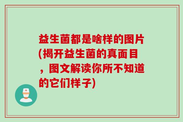 益生菌都是啥样的图片(揭开益生菌的真面目,图文解读你所不知道的它们样子) 益生菌都是啥样的图片(揭开益生菌的真面目,图文解读你所不知道的它们样子)