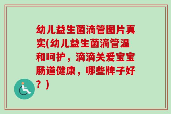 幼儿益生菌滴管图片真实(幼儿益生菌滴管温和呵护，滴滴关爱宝宝肠道健康，哪些牌子好？)