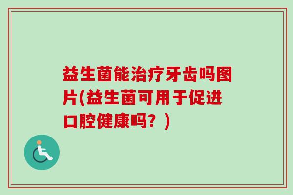 益生菌能牙齿吗图片(益生菌可用于促进口腔健康吗?) 益生菌能牙齿吗图片(益生菌可用于促进口腔健康吗?)