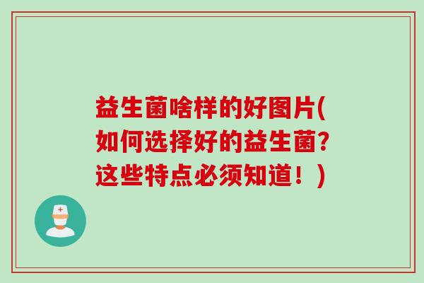 益生菌啥样的好图片(如何选择好的益生菌?这些特点必须知道!) 益生菌啥样的好图片(如何选择好的益生菌?这些特点必须知道!)