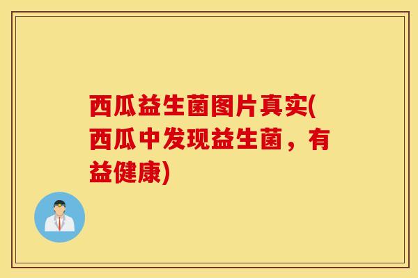 西瓜益生菌图片真实(西瓜中发现益生菌，有益健康)